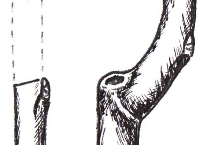 Rez na púčik (správny)