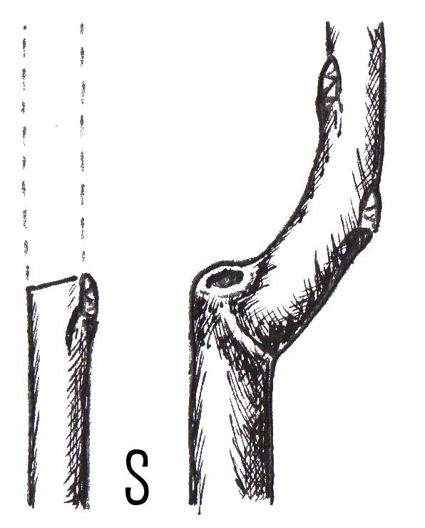 Rez na púčik (správny)