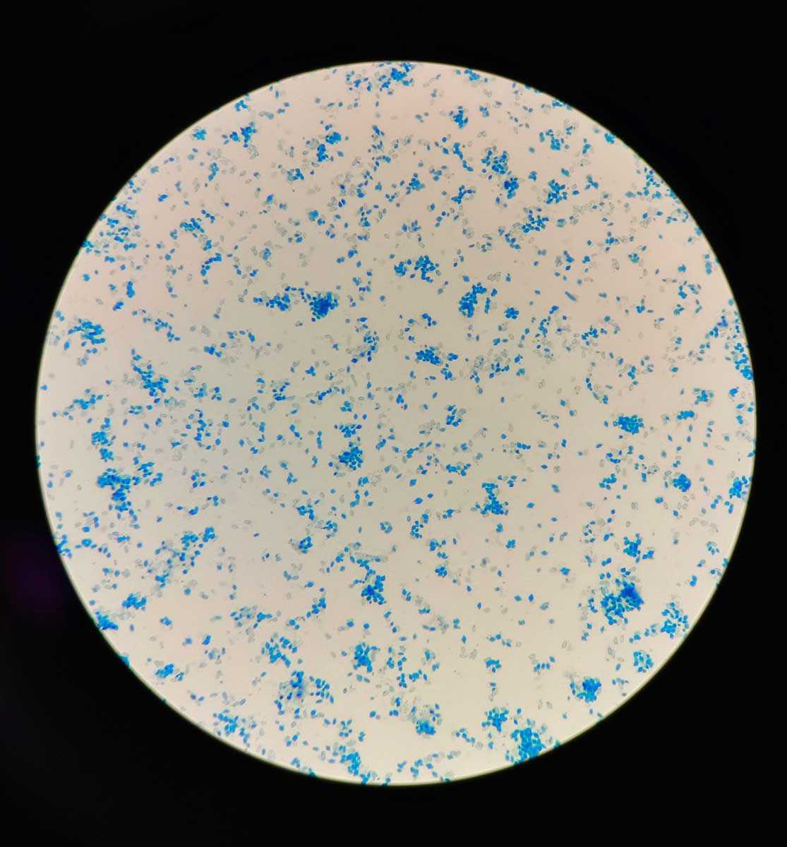 Pôdna baktéria Bacillus thuringiensis produkujúca kryštály
